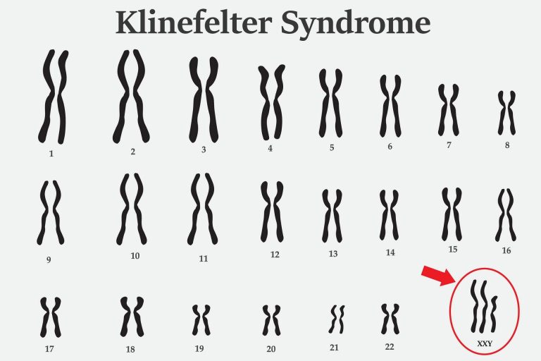 Cosè La Sindrome Di Klinefelter • Plus Magazine 1187